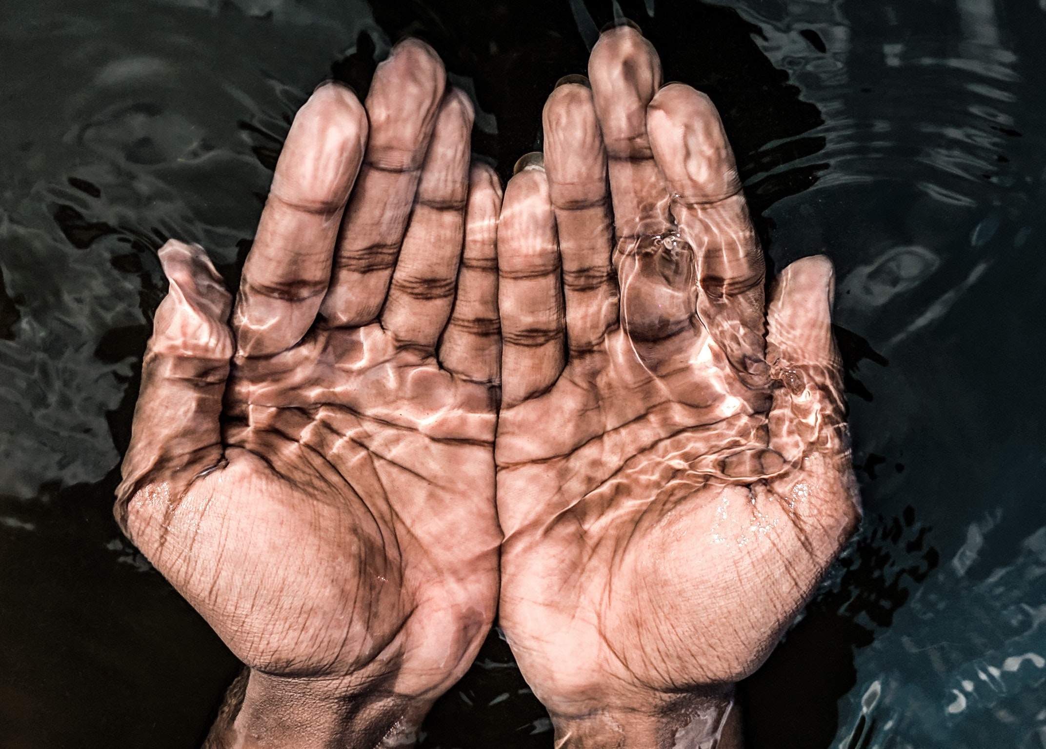 Why Skin Needs Moisture